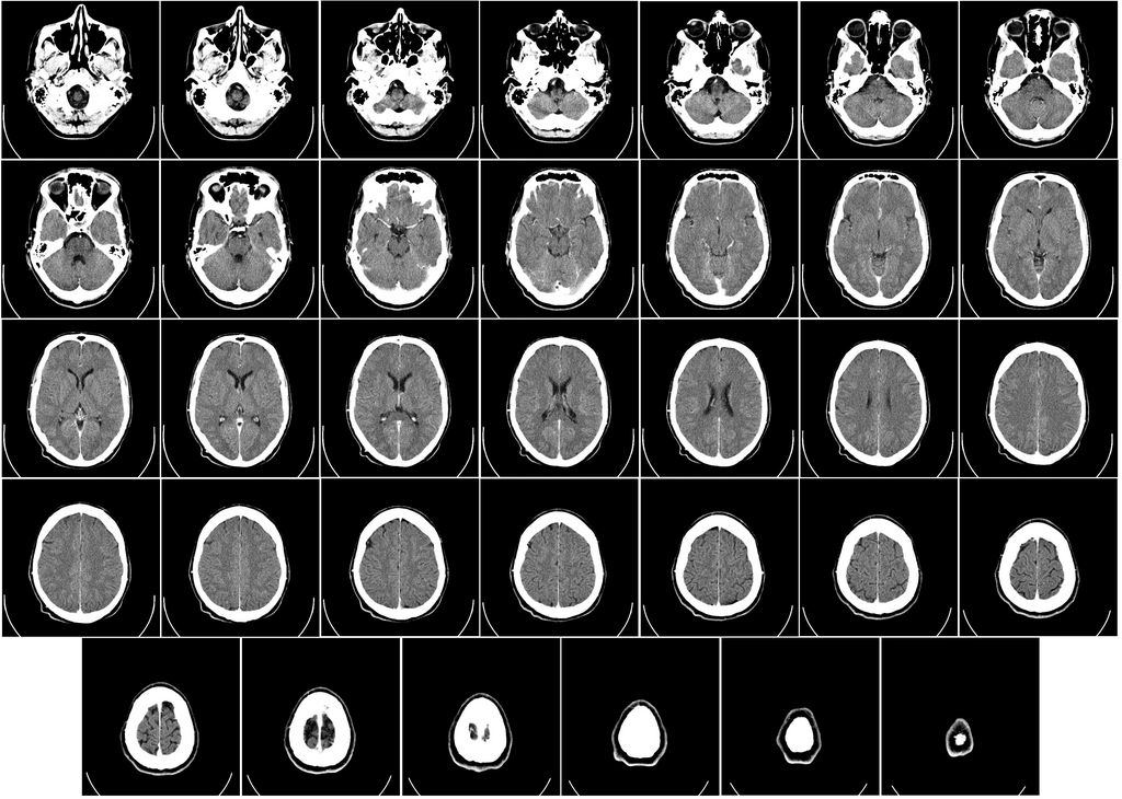 A scan of the human brain. The average adult brain contains one plastic spoon's worth of plastic.